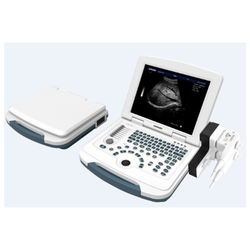Basic Laptop BW Ultrasound Scanner 2D doppler ultrasound scanner China portable ultrasound scanner echo machinery