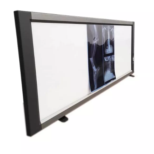 x-ray film viewer x-ray light box الشركة المصنعة للأجهزة والمعدات الطبية Led X Ray View Box