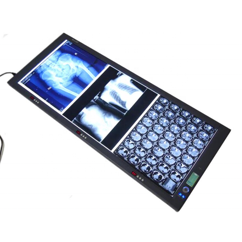 X-ray LED Triple Film Viewer Radiographic Film Viewer Medical led Negatoscope