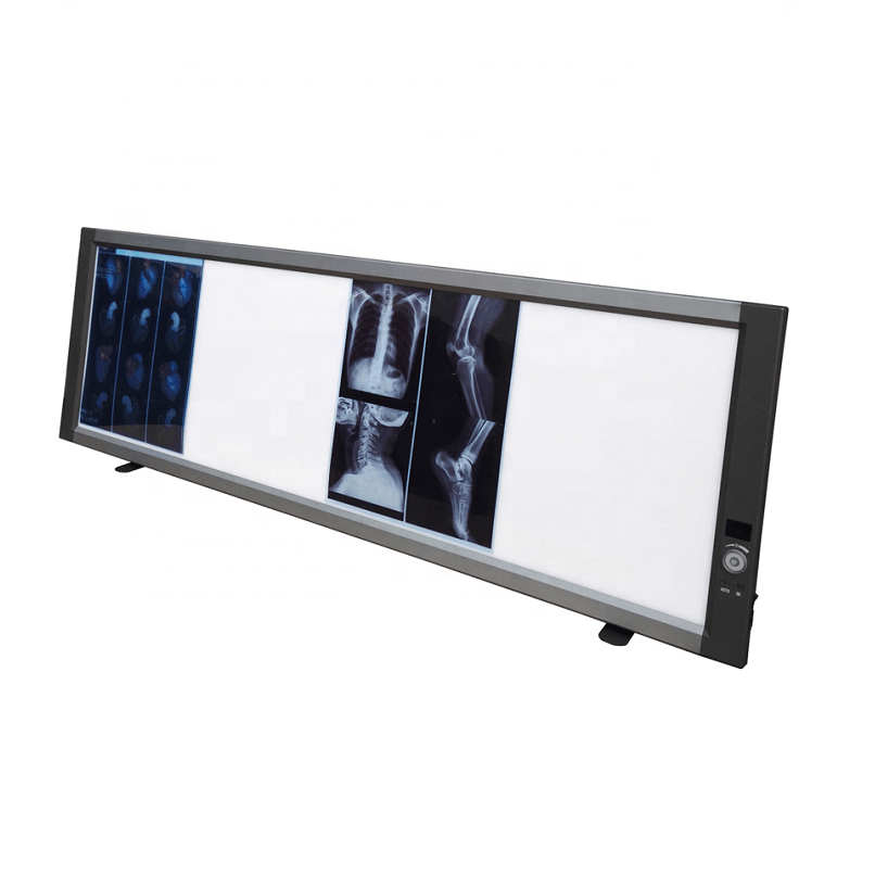 Medical X Ray Film Viewer Portable LED X-Ray Film View Illuminator Radiography Negatoscope